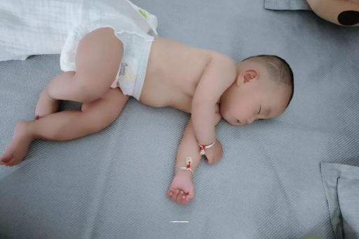 西藏宝宝头上长痱子